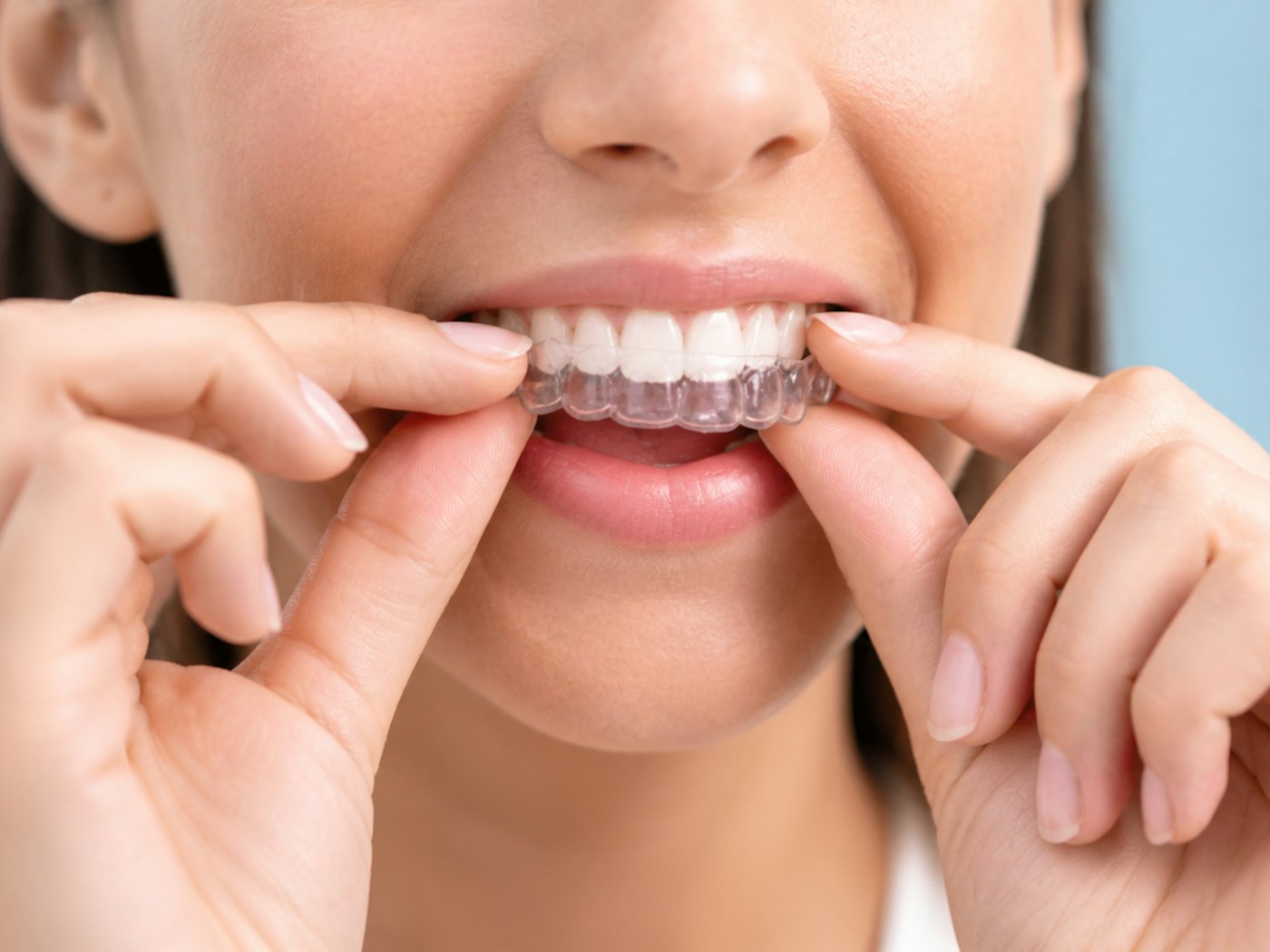 Invisalign&reg;